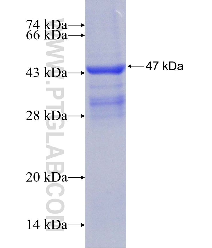 SOAT1 fusion protein Ag30945 SDS-PAGE