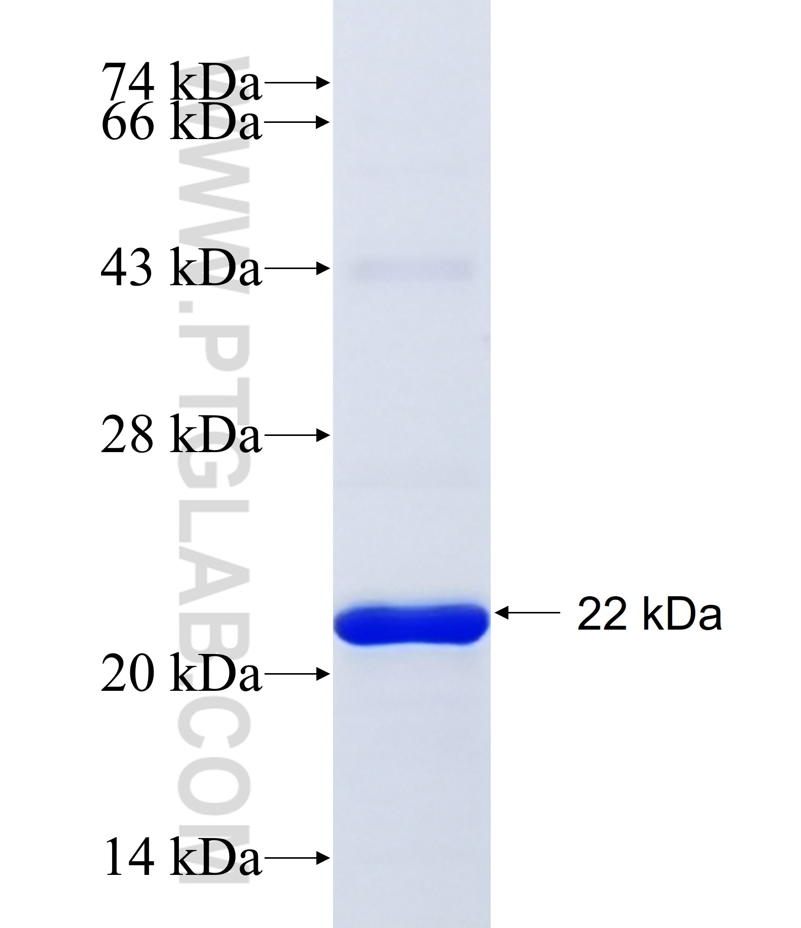 SOAT1 fusion protein Ag30956 SDS-PAGE