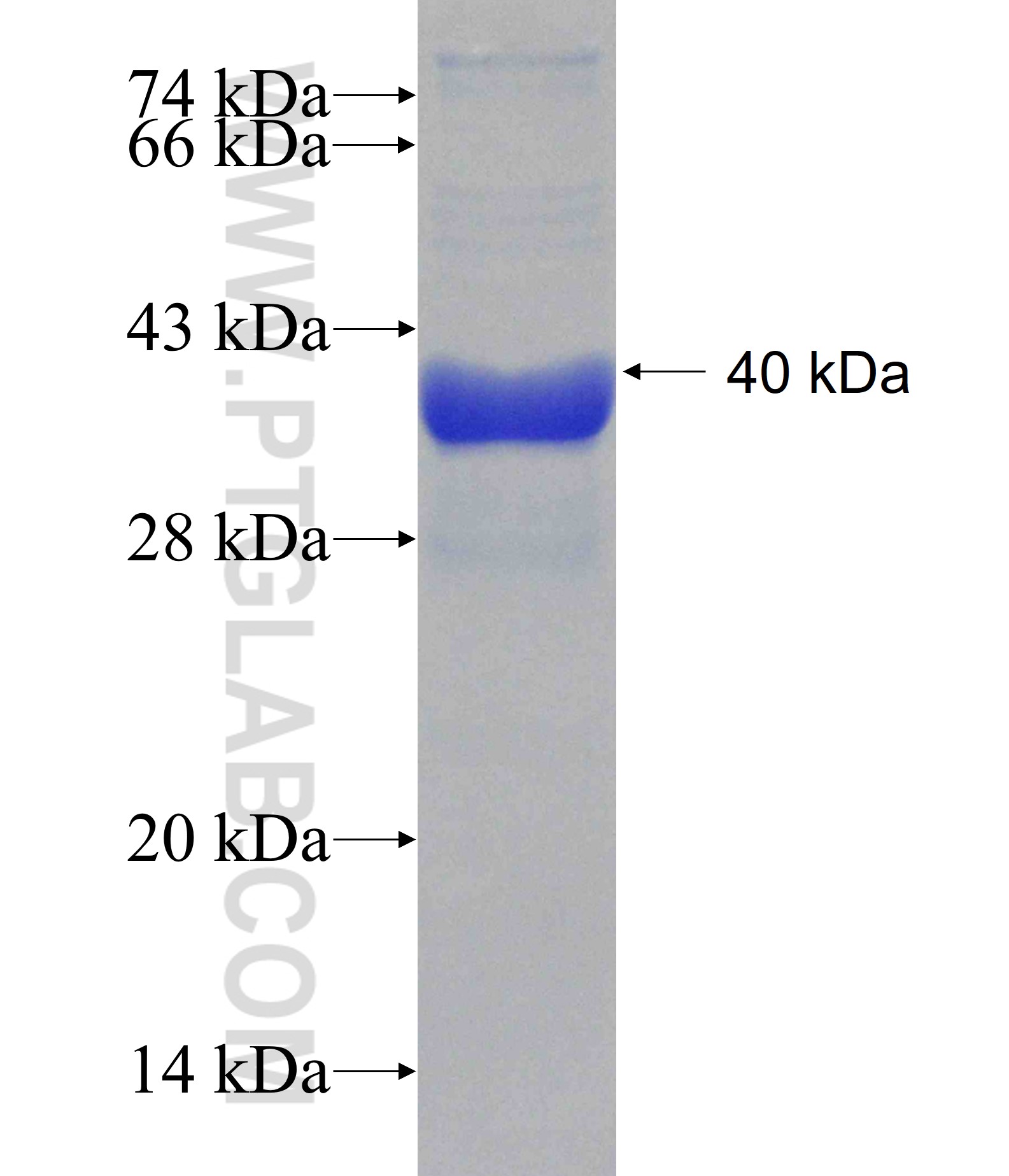 SOAT2 fusion protein Ag16364 SDS-PAGE