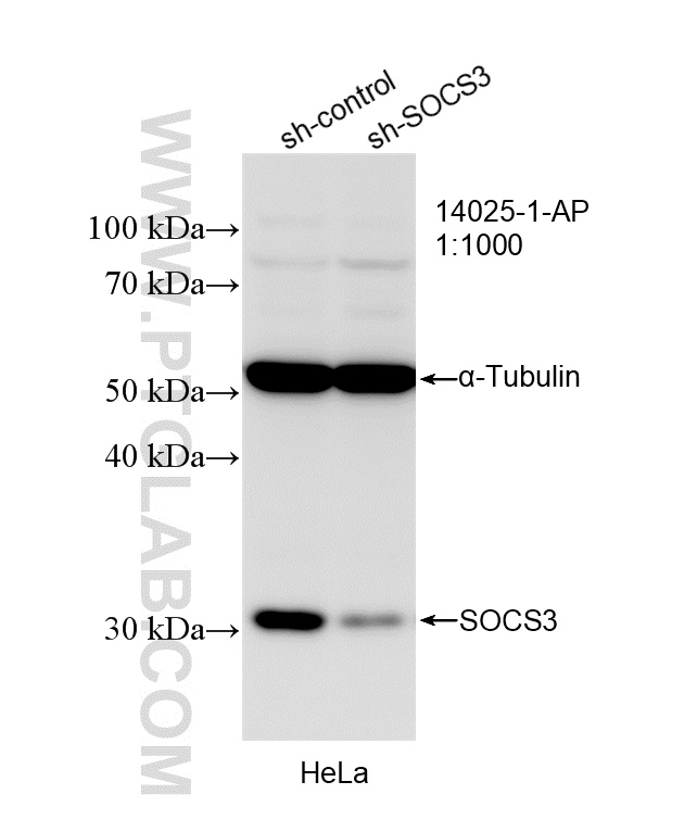 WB analysis of HeLa using 14025-1-AP WB analysis of HeLa using 14025-1-AP