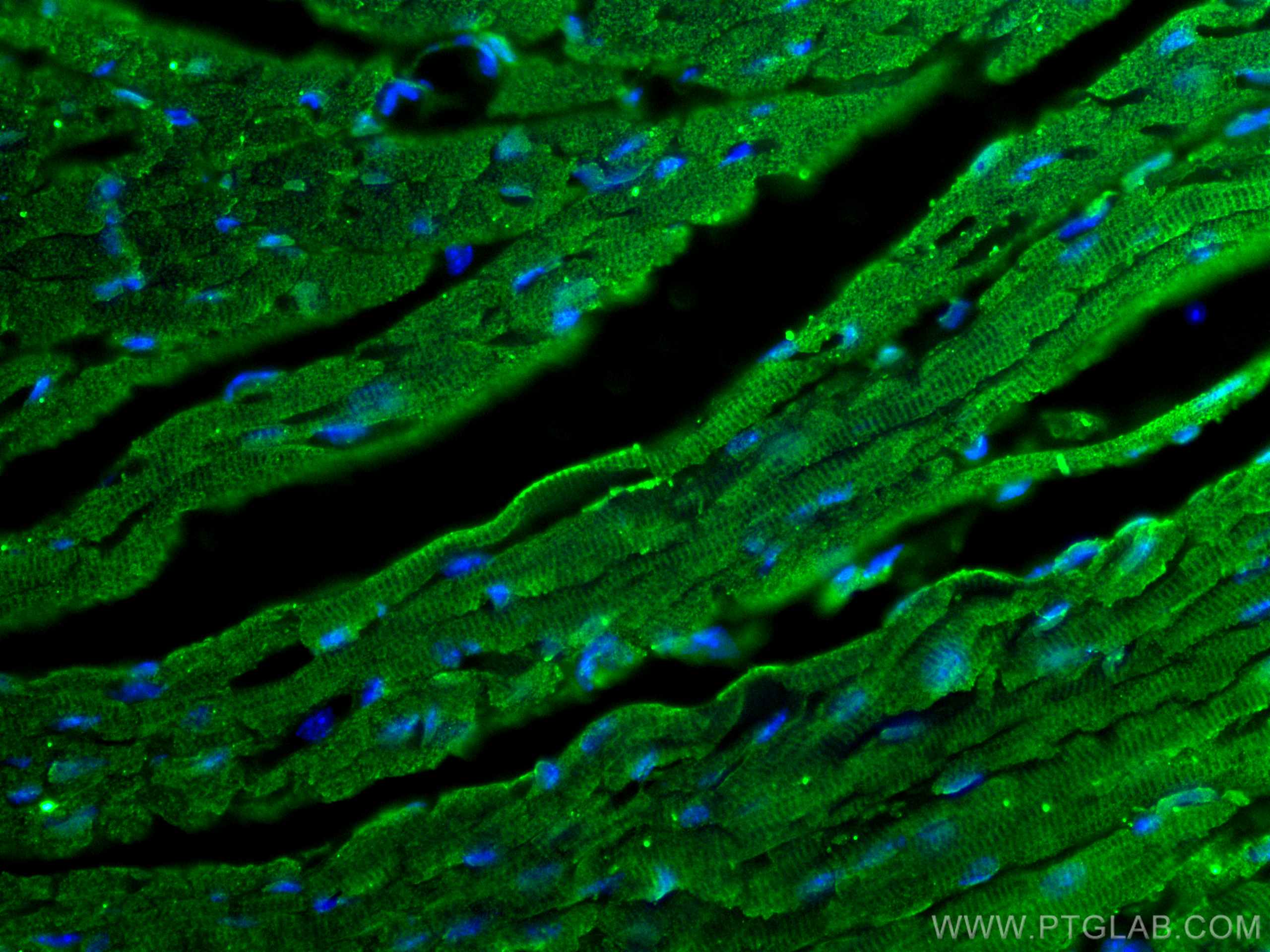 IF Staining of mouse heart using 66797-1-Ig