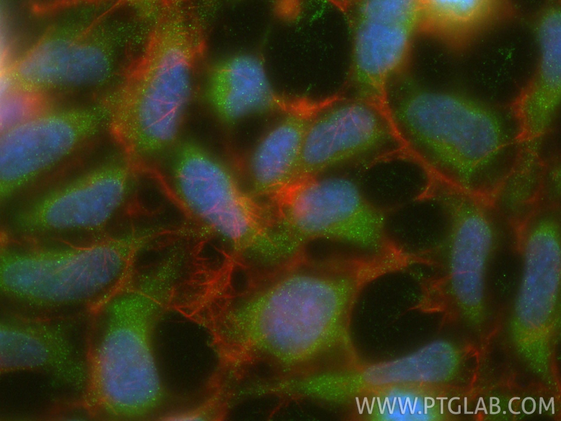 IF Staining of HEK-293 using 66797-1-Ig IF Staining of HEK-293 using 66797-1-Ig
