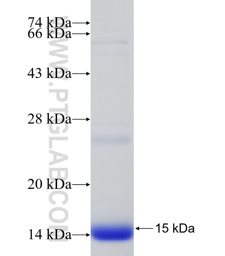 SOCS3 fusion protein Ag31548 SDS-PAGE SOCS3 fusion protein Ag31548 SDS-PAGE