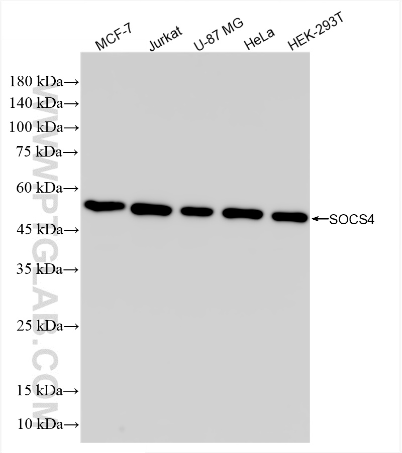 WB analysis using 85626-1-RR (same clone as 85626-1-PBS)