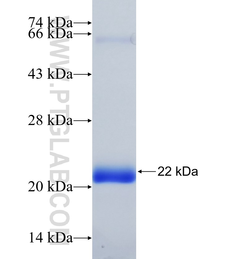 SOCS4 fusion protein Ag35370 SDS-PAGE