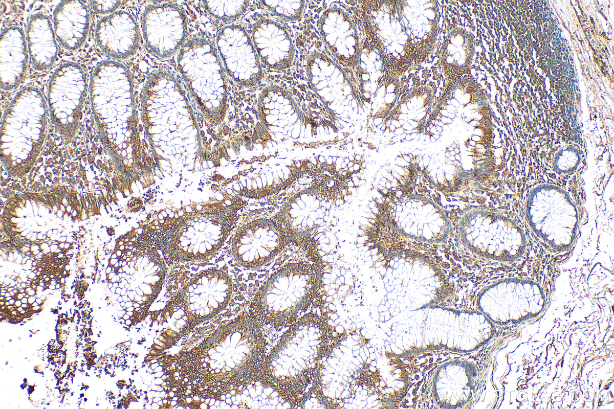 IHC staining of human colon using 27343-1-AP