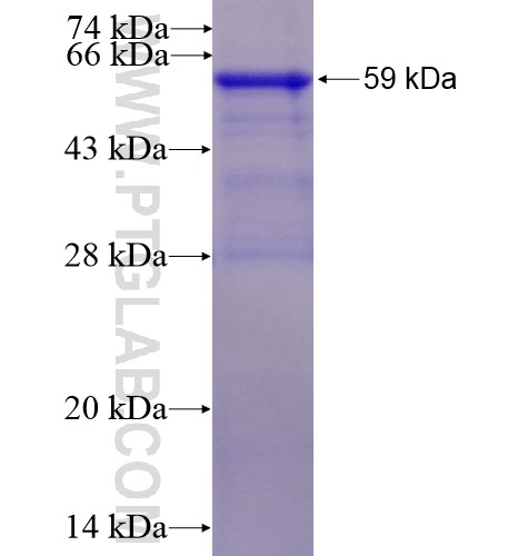 SOCS6 fusion protein Ag3096 SDS-PAGE