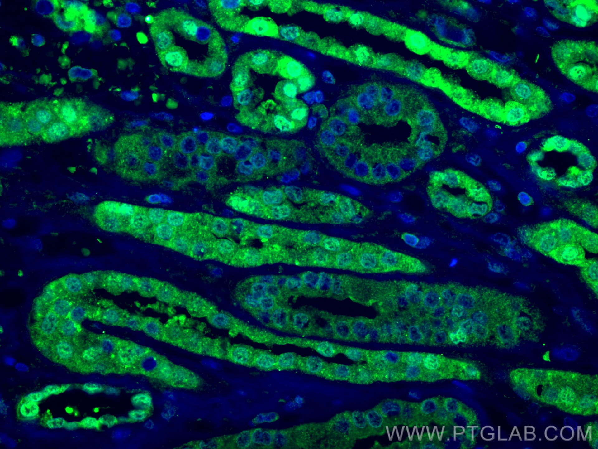 IF Staining of human kidney using 10269-1-AP