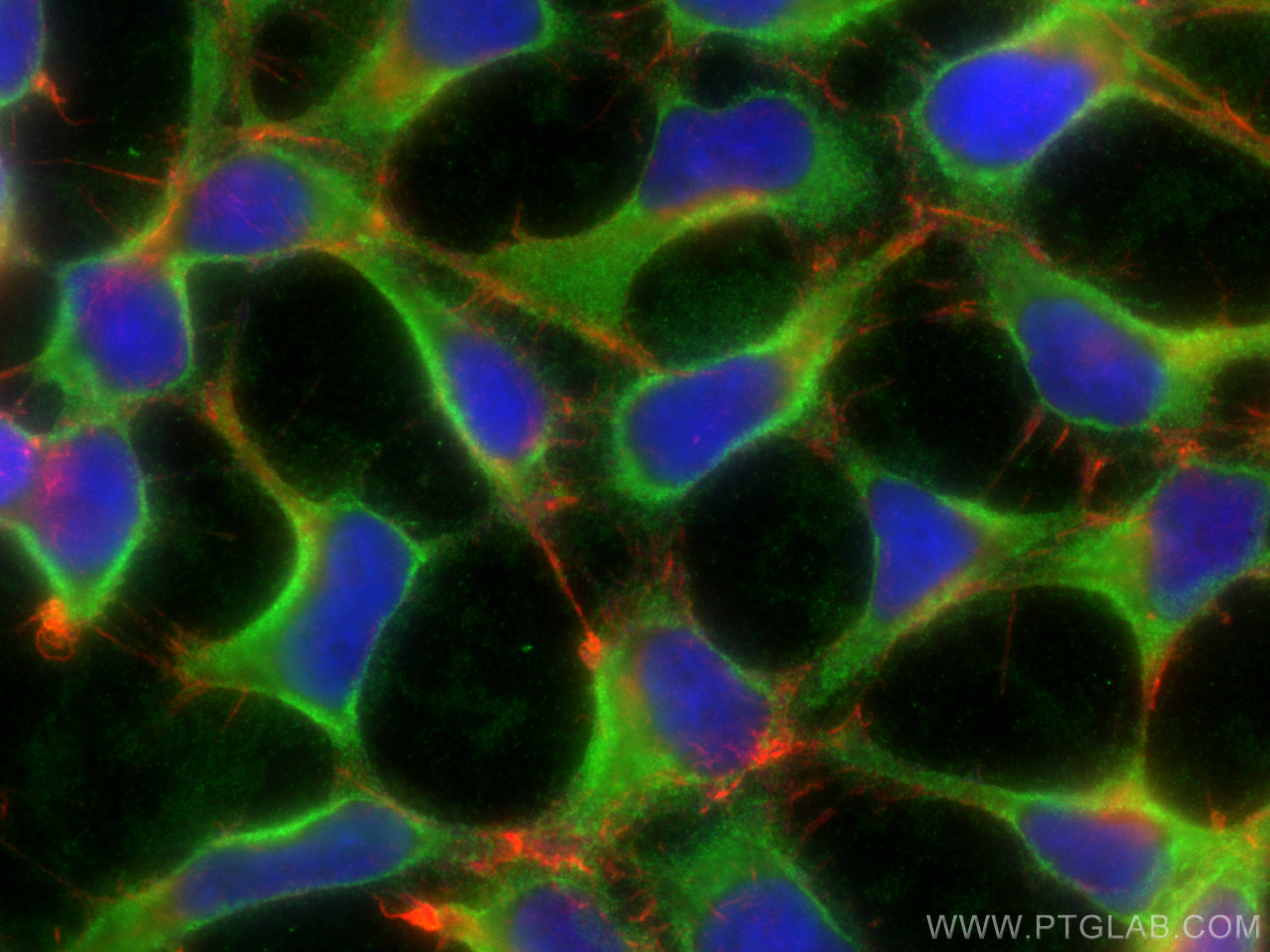 IF Staining of HEK-293 using 10269-1-AP