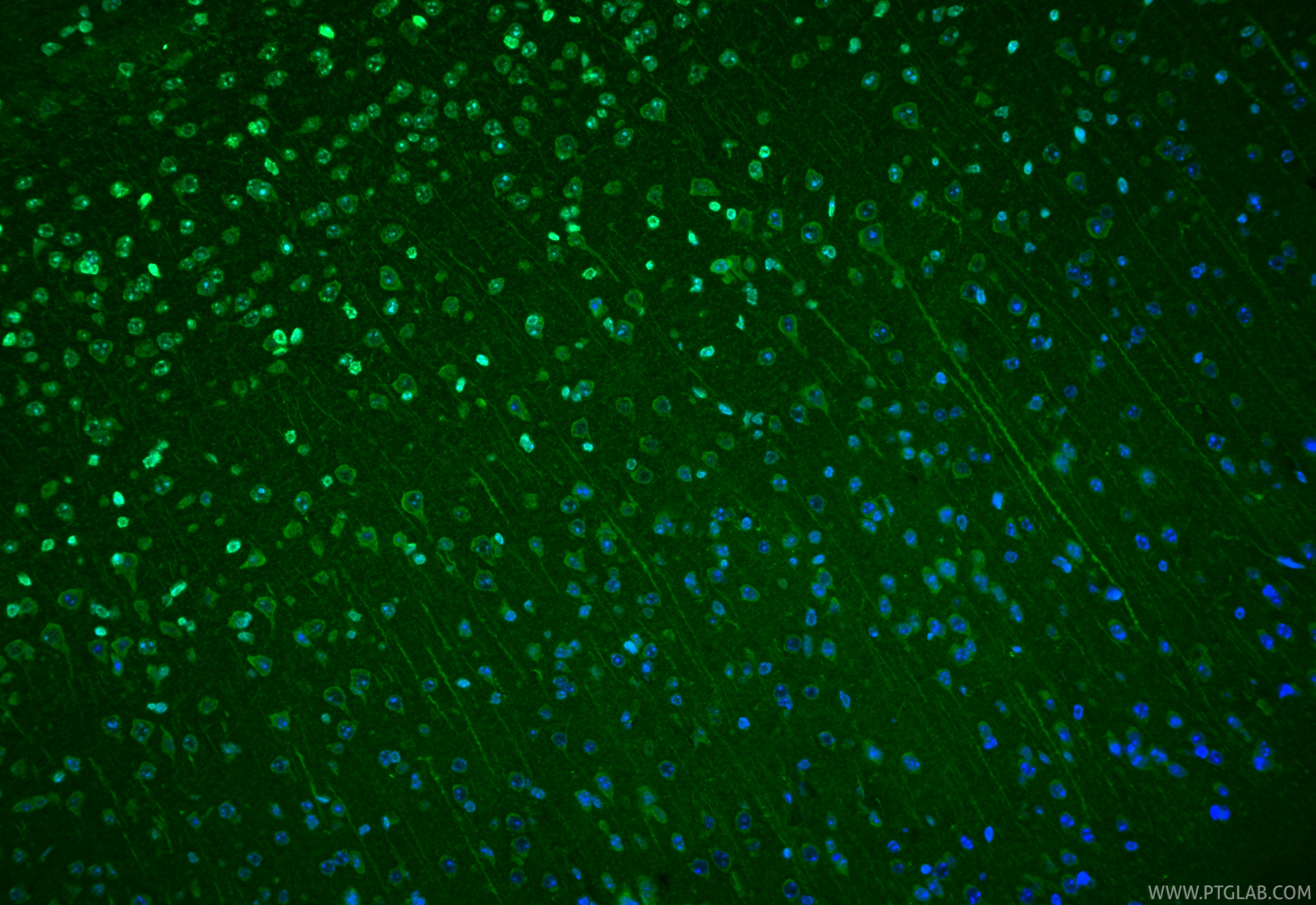 IF Staining of mouse brain using 31400-1-AP