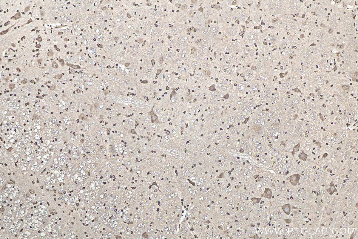 IHC staining of rat cerebellum using 67480-1-Ig IHC staining of rat cerebellum using 67480-1-Ig