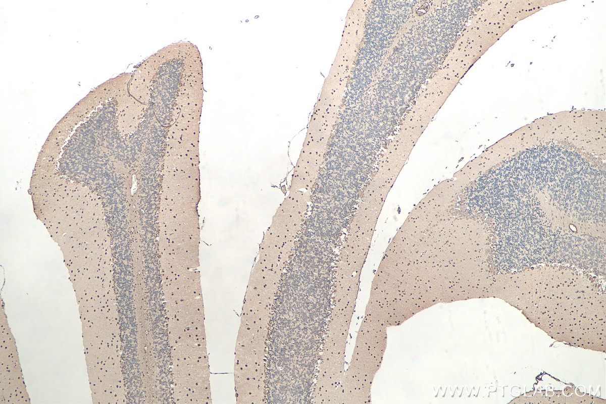 IHC staining of mouse cerebellum using 67480-1-Ig IHC staining of mouse cerebellum using 67480-1-Ig