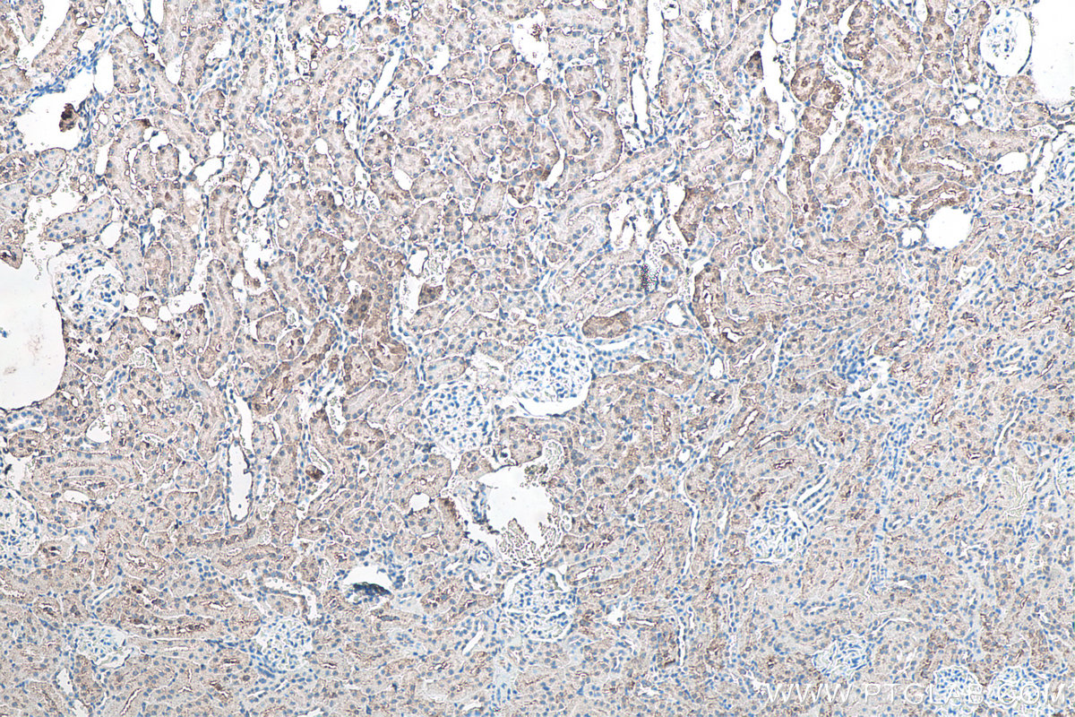 IHC staining of rat kidney using 67480-1-Ig IHC staining of rat kidney using 67480-1-Ig