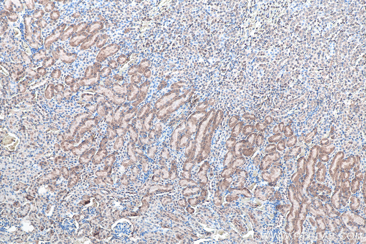 IHC staining of mouse kidney using 67480-1-Ig IHC staining of mouse kidney using 67480-1-Ig