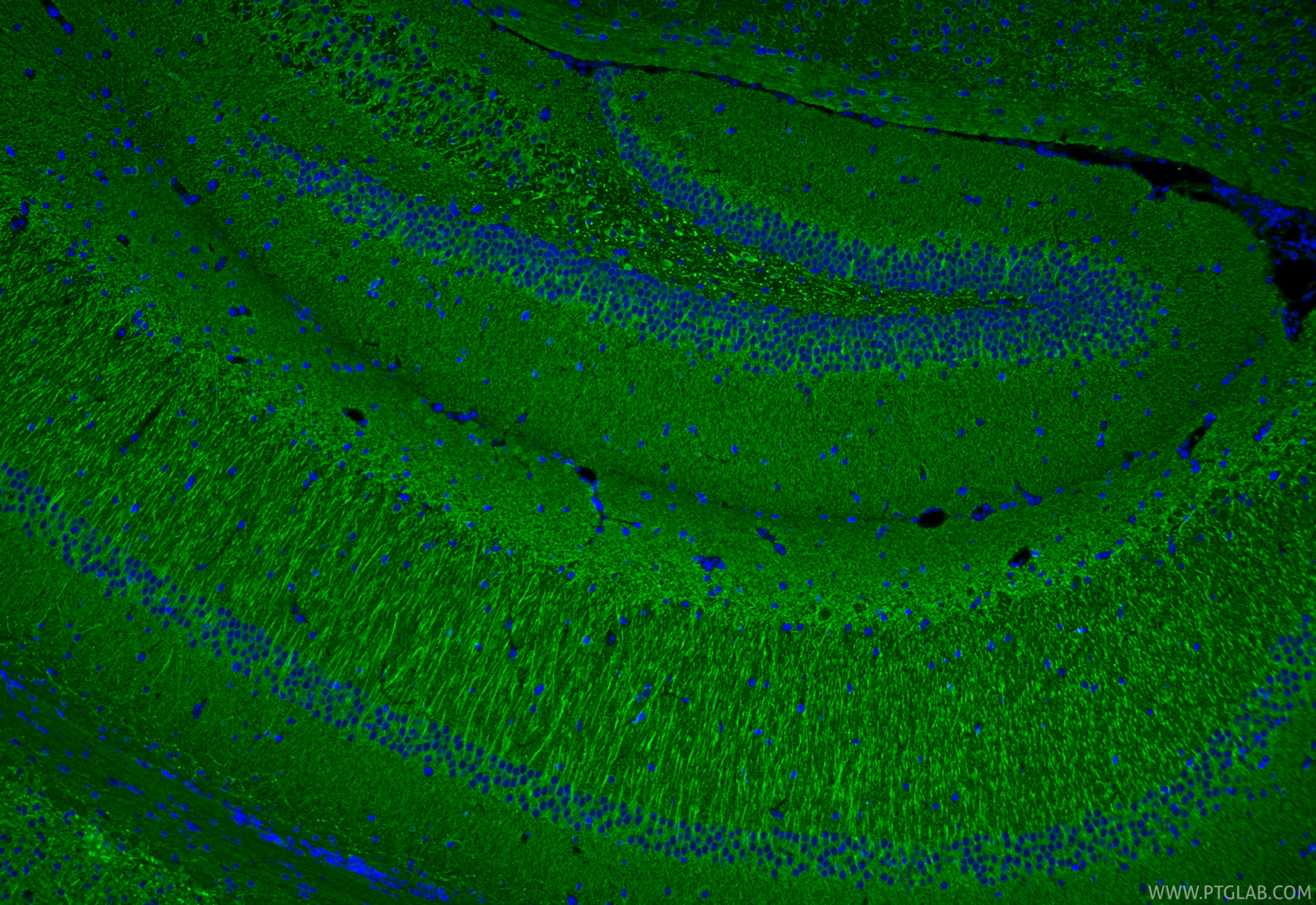 IF Staining of mouse brain using 83857-6-RR IF Staining of mouse brain using 83857-6-RR