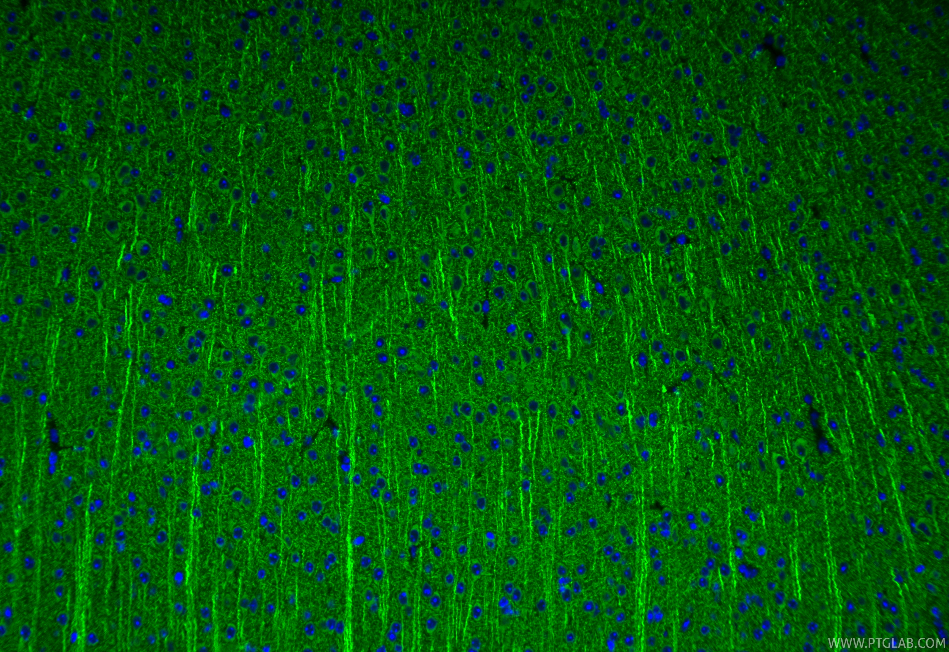 IF Staining of mouse brain using 83857-6-RR IF Staining of mouse brain using 83857-6-RR