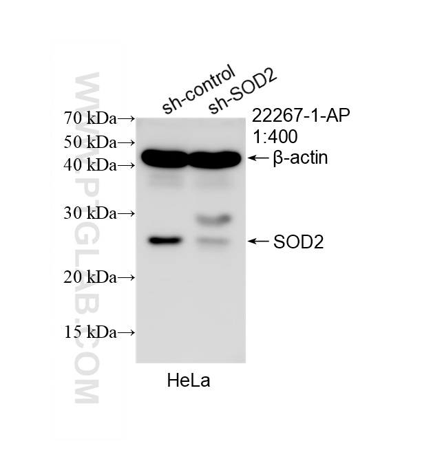 WB analysis of HeLa using 22267-1-AP