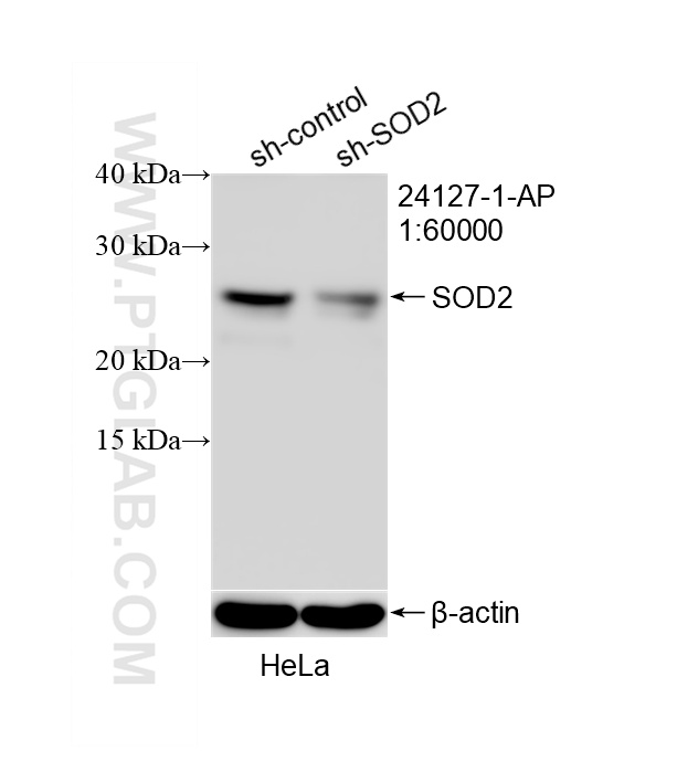 WB analysis of HeLa using 24127-1-AP