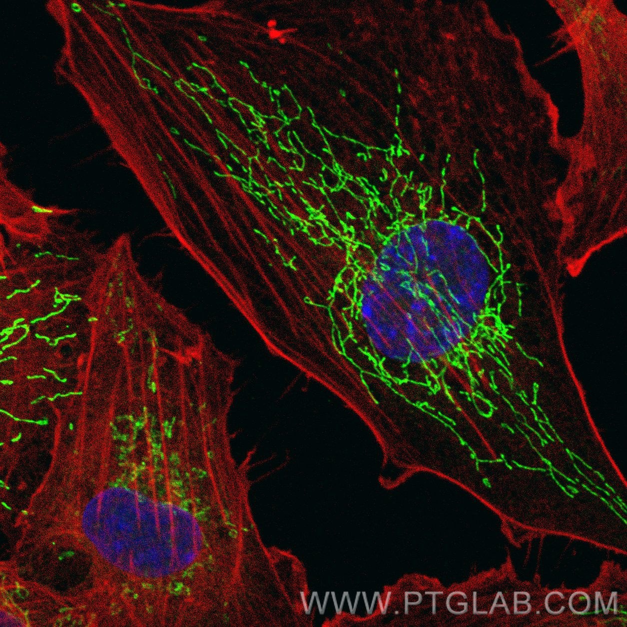 IF Staining of HUVEC using 66474-1-Ig