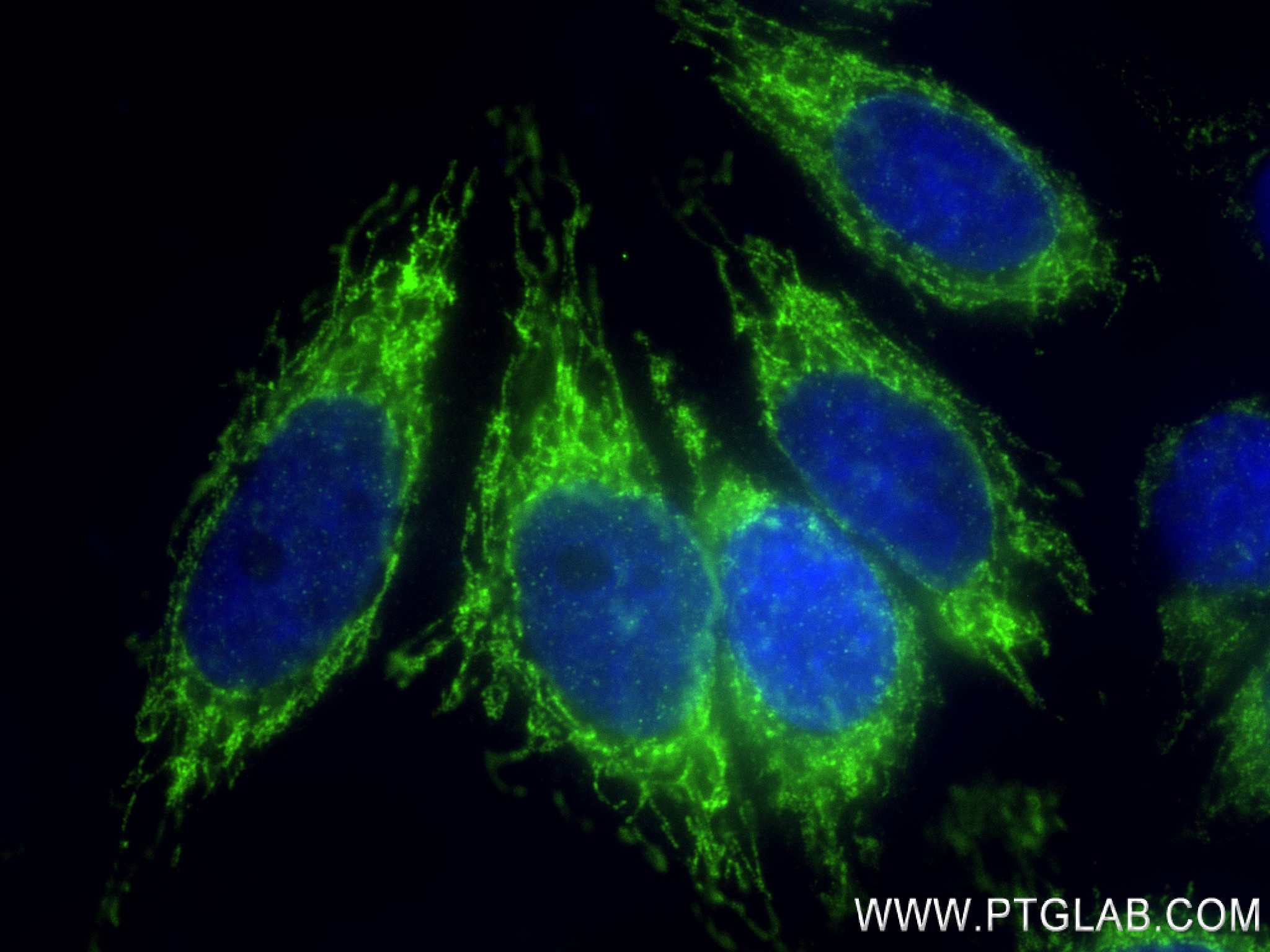 IF Staining of HepG2 using 83519-2-RR (same clone as 83519-2-PBS)