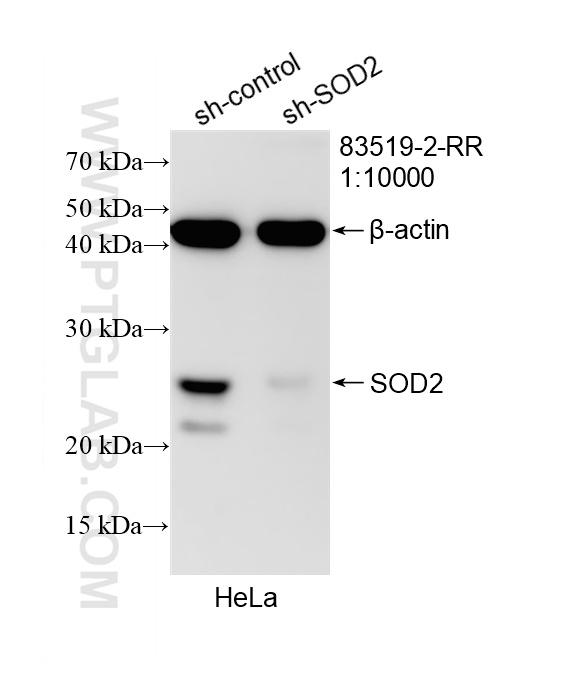 WB analysis of HeLa using 83519-2-RR (same clone as 83519-2-PBS)