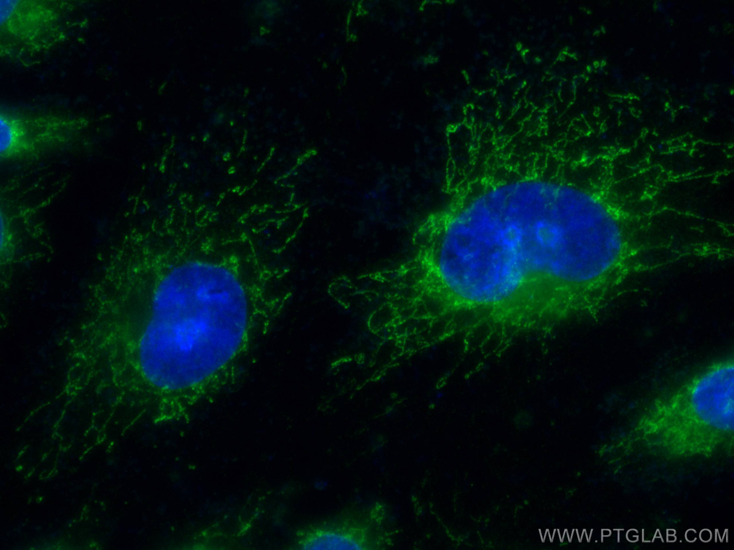 IF Staining of HUVEC using CL488-66474