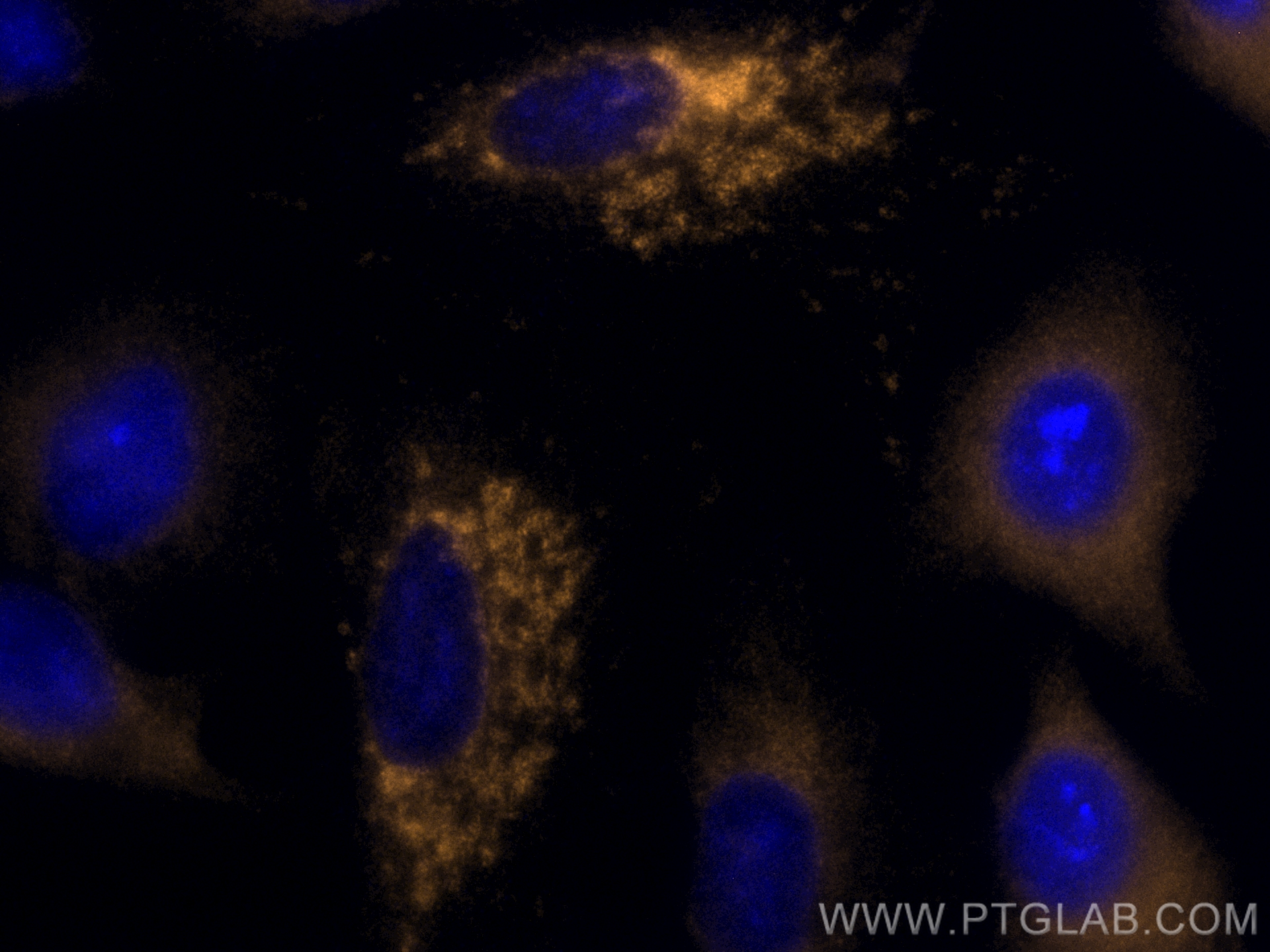 IF Staining of A549 using CL555-66474