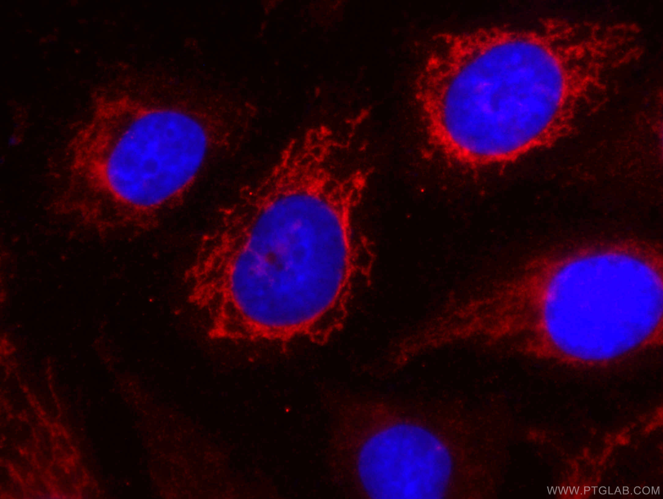 IF Staining of HUVEC using CL594-66474