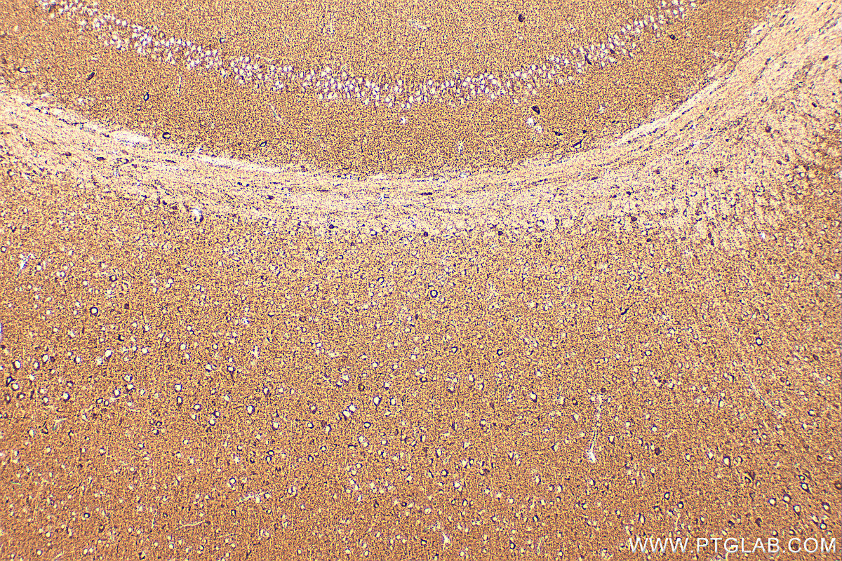 IHC staining of mouse brain using RMX00079 IHC staining of mouse brain using RMX00079