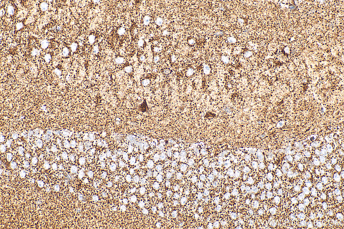 IHC staining of mouse brain using RMX00079 IHC staining of mouse brain using RMX00079