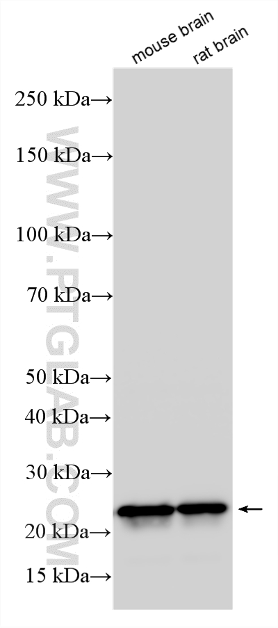 WB analysis using RMX00079 WB analysis using RMX00079