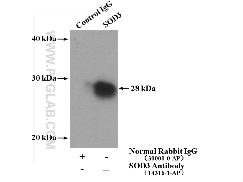 IP experiment of human placenta using 14316-1-AP