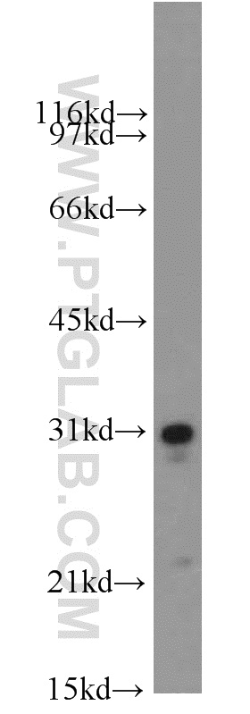 SOD3 Polyclonal antibody