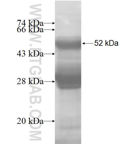 SOD3 fusion protein Ag5556 SDS-PAGE