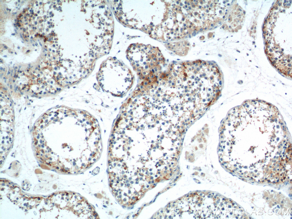 IHC staining of human testis using 17753-1-AP