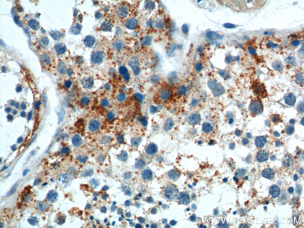 IHC staining of human testis using 17753-1-AP