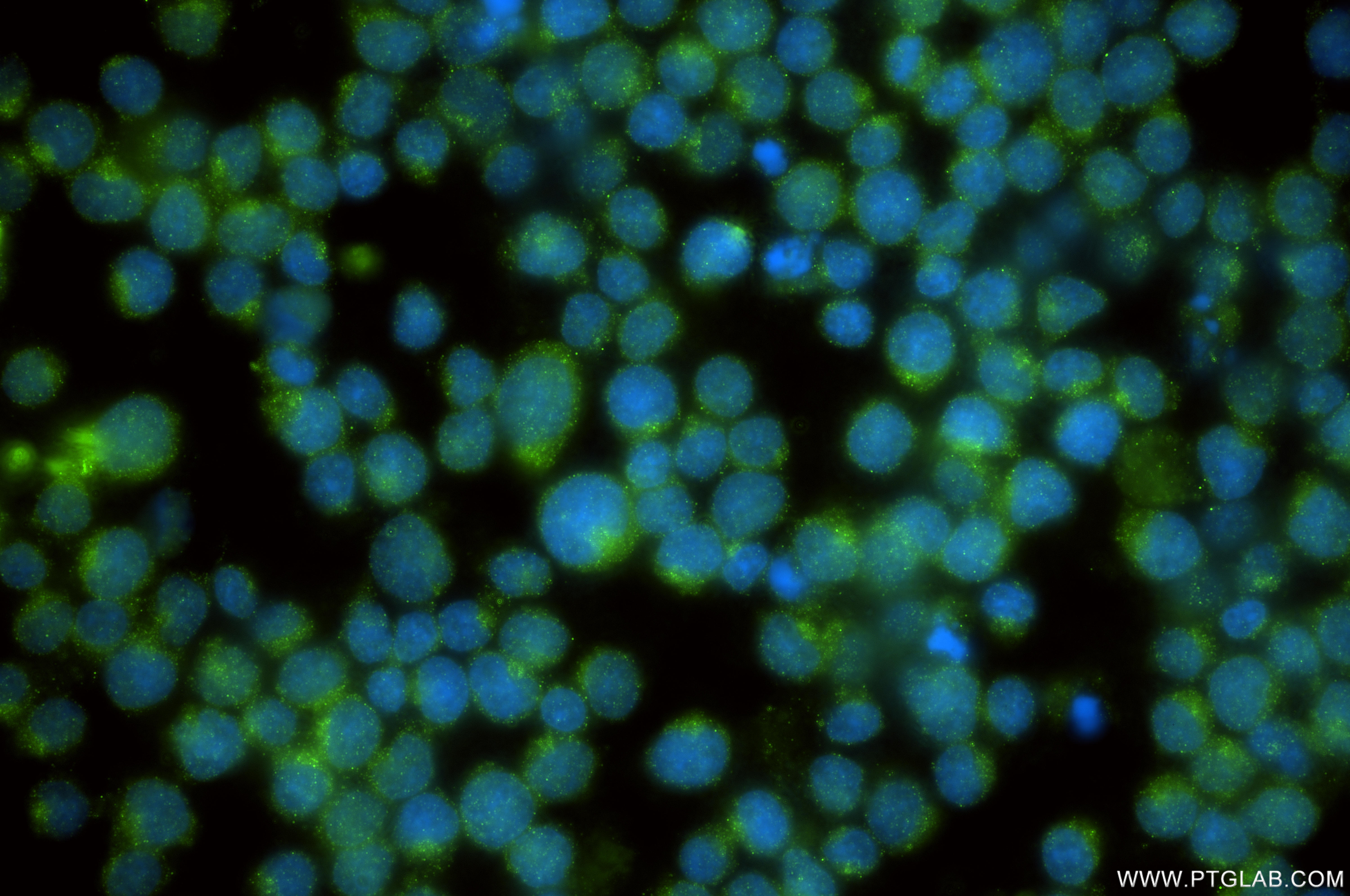 IF Staining of Jurkat using 86875-2-RR (same clone as 86875-2-PBS)