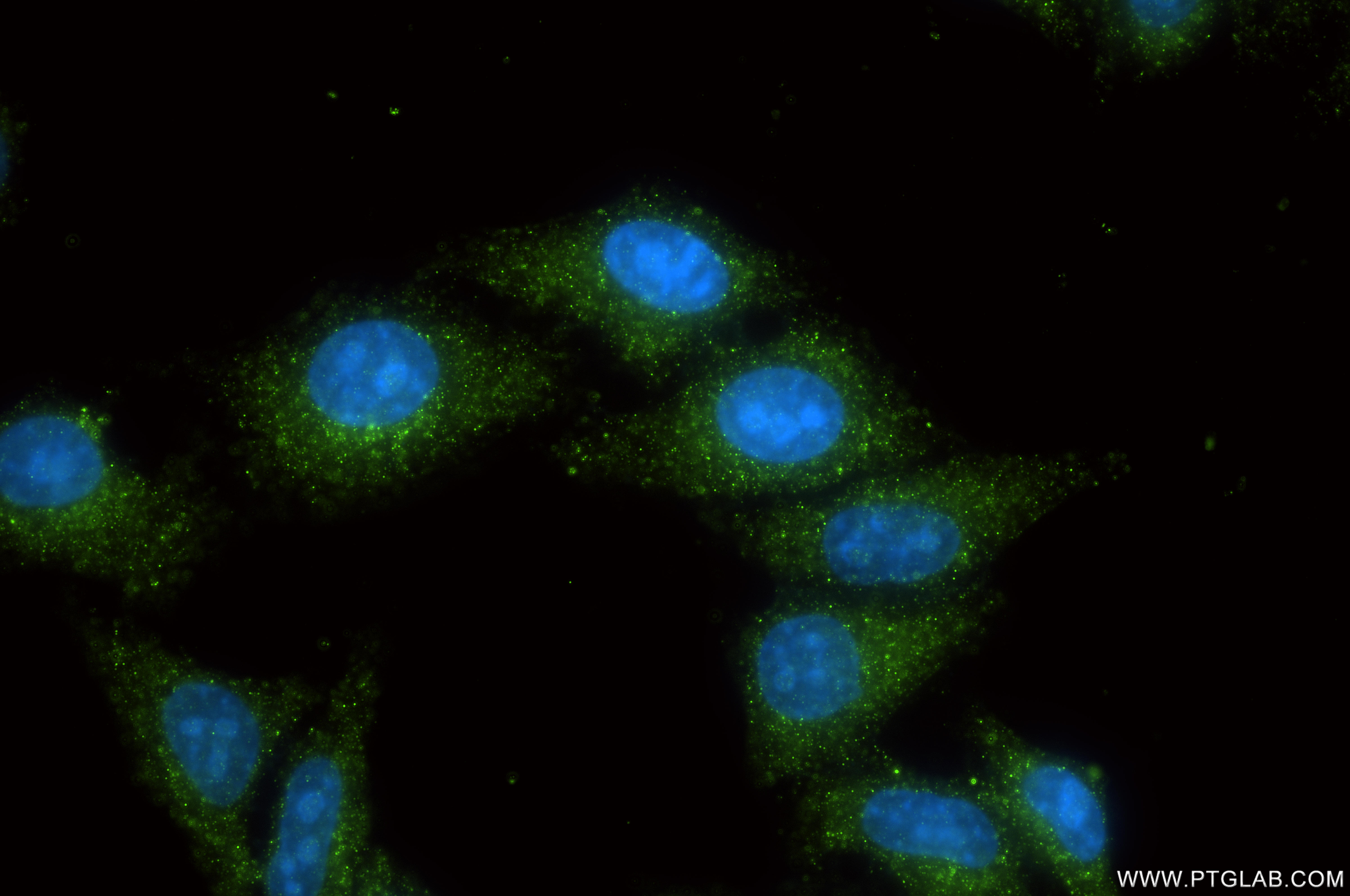 IF Staining of HepG2 using 86875-2-RR (same clone as 86875-2-PBS)