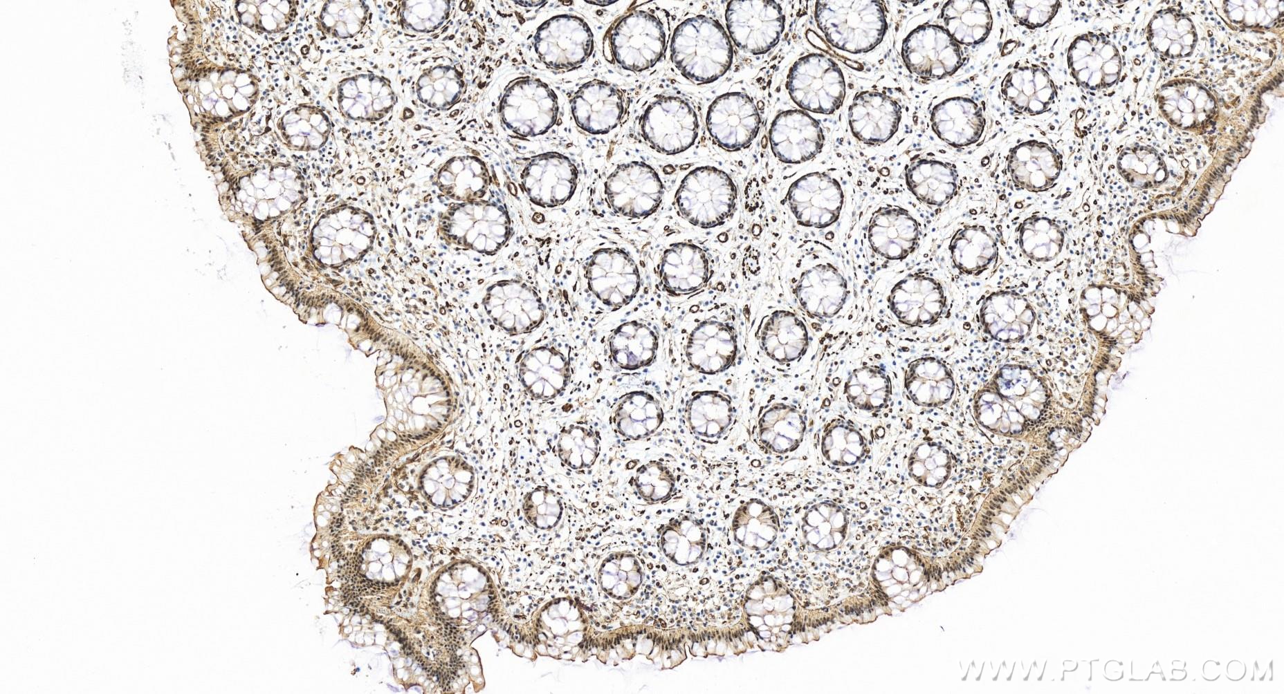 IHC staining of human colon using 83787-5-RR (same clone as 83787-5-PBS)