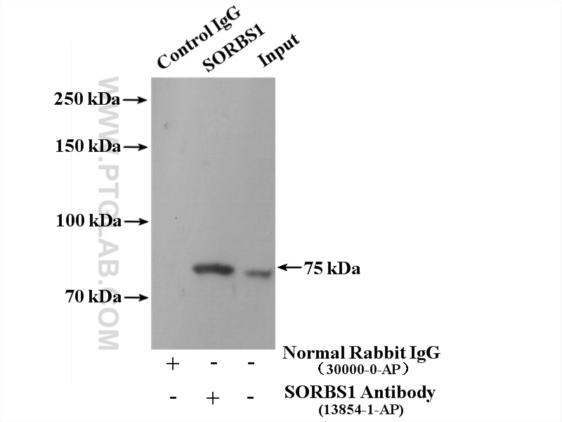 IP experiment of mouse liver using 13854-1-AP