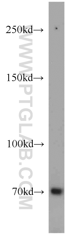 WB analysis of 3T3-L1 using 13854-1-AP