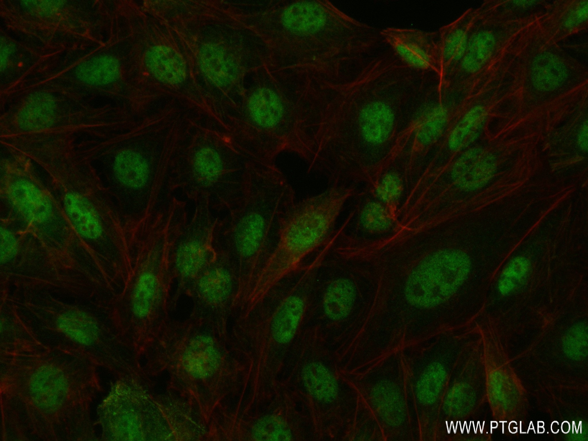 IF Staining of U2OS using 83189-3-RR
