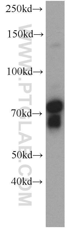 WB analysis of Y79 using 18839-1-AP