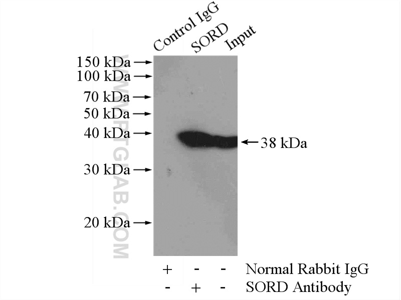 IP experiment of mouse liver using 15881-1-AP