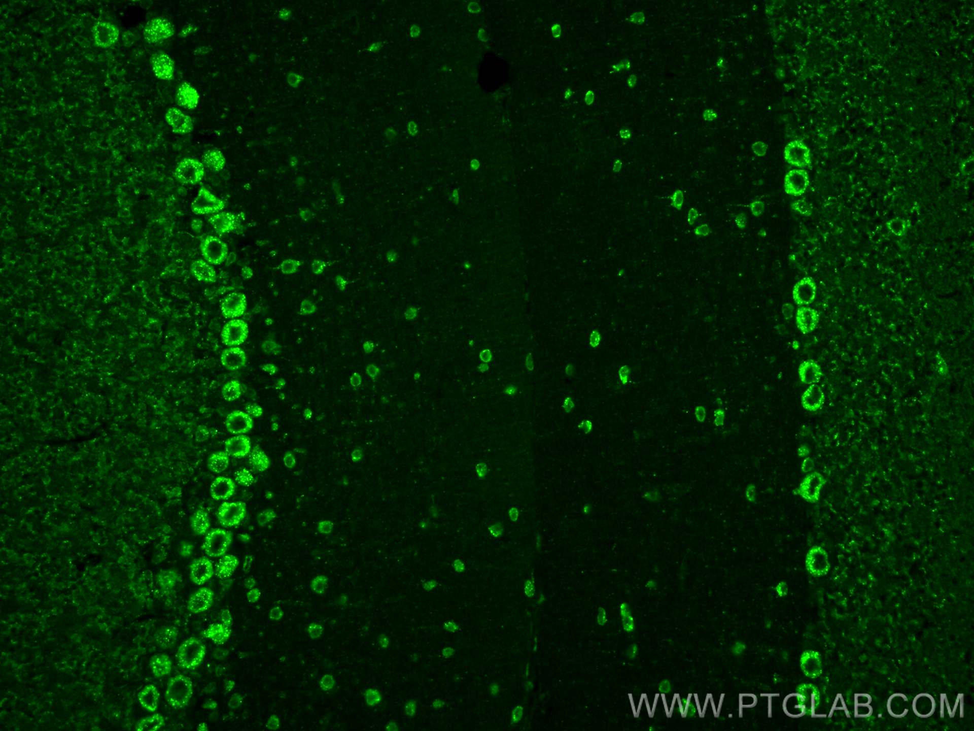 IF Staining of mouse cerebellum using 22592-1-AP