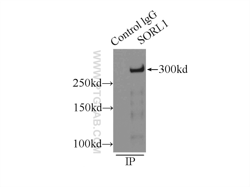 IP experiment of mouse brain using 22592-1-AP