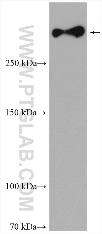 WB analysis of mouse brain using 22592-1-AP