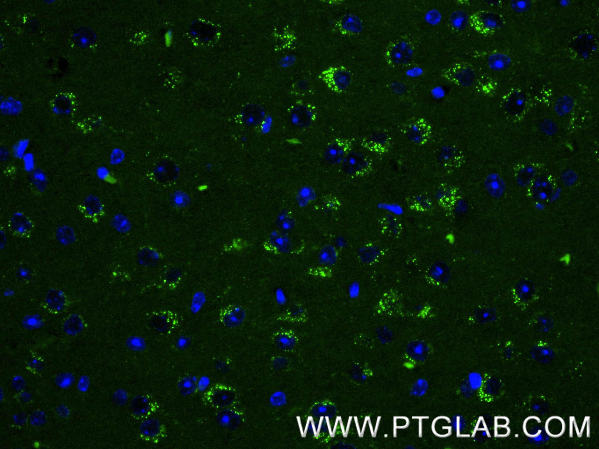 IF Staining of mouse brain using 87882-1-RR