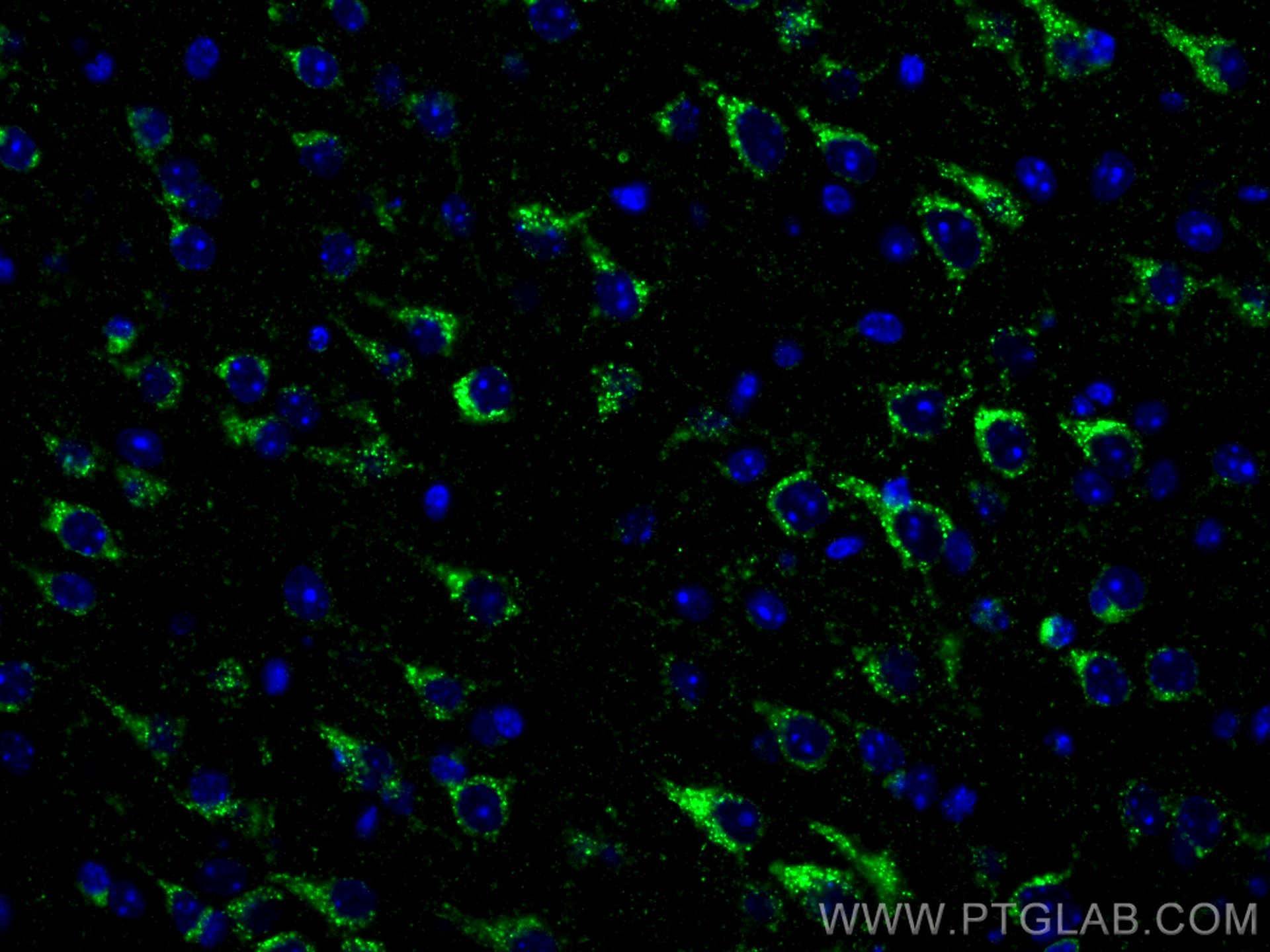 IF Staining of mouse brain using 12369-1-AP (same clone as 12369-1-PBS)