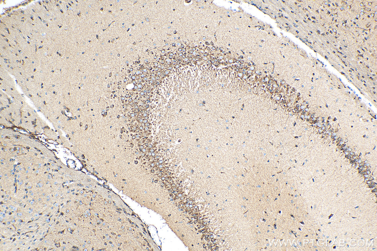 IHC staining of mouse brain using 12369-1-AP (same clone as 12369-1-PBS)